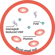 normal blood vessel with abnormal clotting